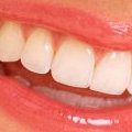 De jolies dents blanches !