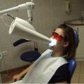 Une séance de blanchiment des dents chez le dentiste