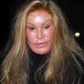 Un phénomène célèbre de la chirurgie esthétique : Jocelyne Wildenstein