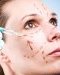 Chirurgie esthétique