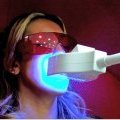 Le blanchiment des dents au laser