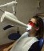 Une séance de blanchiment des dents chez le dentiste