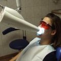 Une séance de blanchiment des dents chez le dentiste