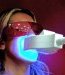 Le blanchiment des dents au laser