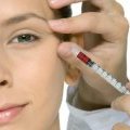 La nouvelle tendance maquillage : le vampire lift