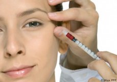 La nouvelle tendance maquillage : le vampire lift