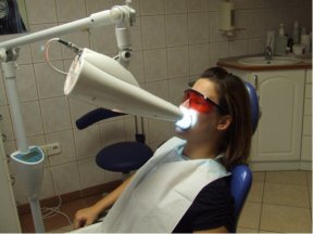 Une séance de blanchiment des dents chez le dentiste