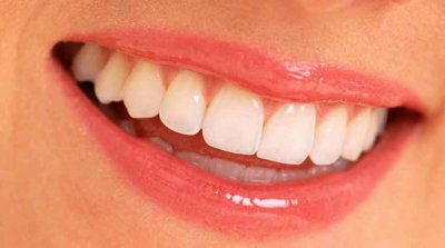 De jolies dents blanches !
