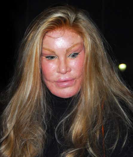 Un phénomène célèbre de la chirurgie esthétique : Jocelyne Wildenstein